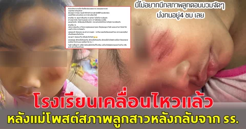 โรงเรียนเคลื่อนไหวแล้ว หลังแม่โพสต์ ลูกสาววัย 4 ขวบ กลับจากโรงเรียน หัวปูด-ตาปิด