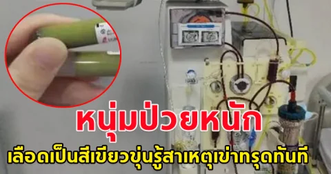 หนุ่มจีนป่วยหนัก เลือดเป็นสีเขียวขุ่น รู้สาเหตุเข่าทรุดทันที อันตรายมาก