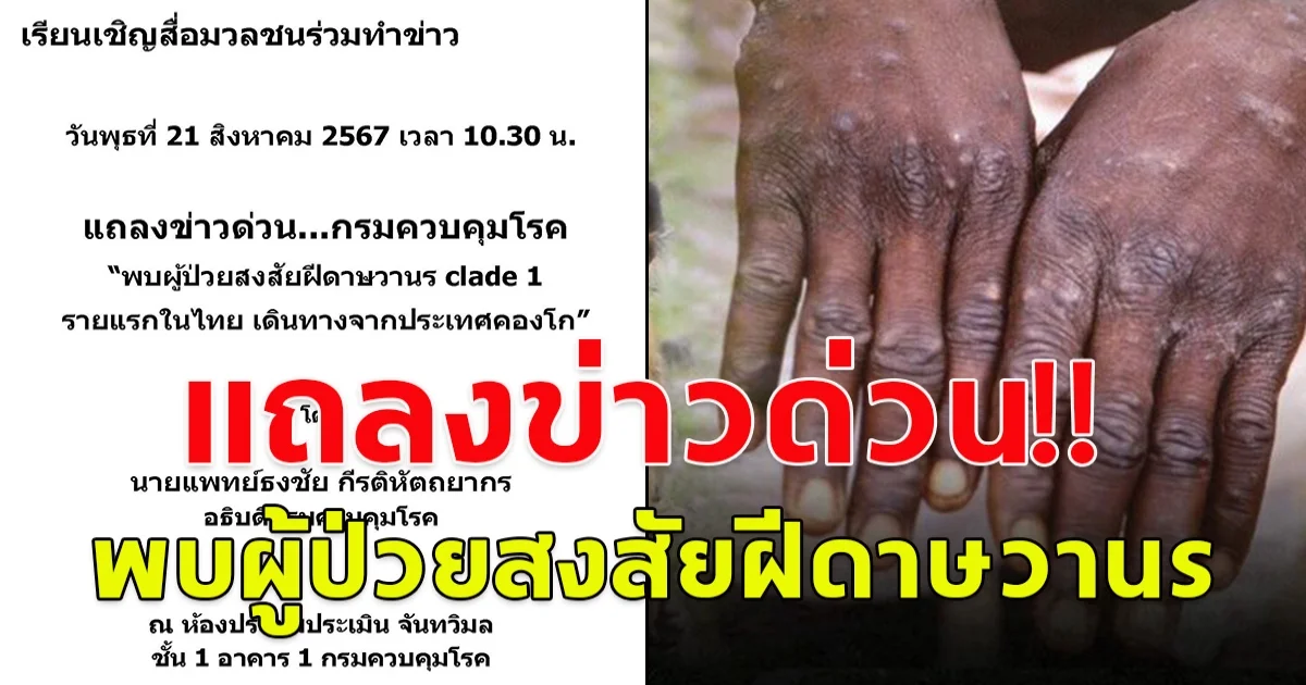 แถลงข่าวด่วน! กรมควบคุมโรค พบผู้ป่วยสงสัยฝีดาษวานร รายแรกในไทย
