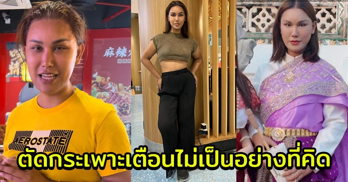 แอนนา เทียบภาพปัจจุบัน-หลังตัดกระเพาะ เตือนไม่เป็นอย่างที่คิด