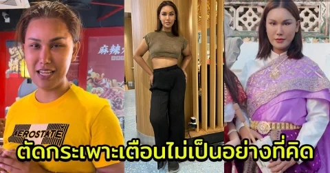 แอนนา เทียบภาพปัจจุบัน-หลังตัดกระเพาะ เตือนไม่เป็นอย่างที่คิด