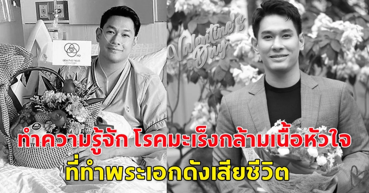 ทำความรู้จัก โรคมะเร็งกล้ามเนื้อหัวใจ ที่ทำพระเอกดังเสียชีวิต