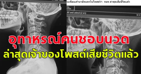 อุทาหรณ์คนชอบนวด สาวแชร์ประสบการณ์หลังจากไปนวดแล้วปวดท้ายทอย ล่าสุดเจ้าของโพสต์เสียชีวิตแล้ว
