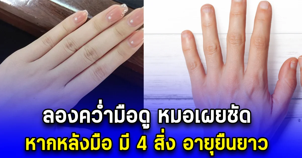 ลองคว่ำมือดู หมอเผยชัด หากหลังมือ มี 4 สิ่ง อายุยืนยาว