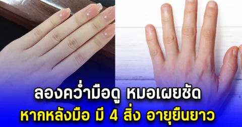 ลองคว่ำมือดู หมอเผยชัด หากหลังมือ มี 4 สิ่ง อายุยืนยาว
