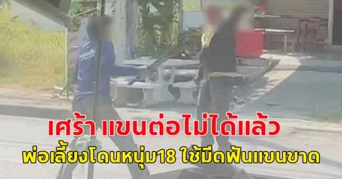 เศร้า แขนต่อไม่ได้แล้ว พ่อเลี้ยงโดนหนุ่ม18 ใช้มีดฟันแขนขาด ตร.จ่อเอาผิดเพิ่ม