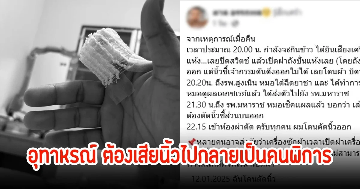 อุทาหรณ์ เอานิ้วแหย่ฝาถังเครื่องซักผ้าโดนดูดปั่นนิ้วขาด เผยเป็นนักดนตรีเสียใจอาจจะไม่ได้กลับไปเล่นอีก