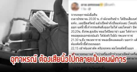 อุทาหรณ์ เอานิ้วแหย่ฝาถังเครื่องซักผ้าโดนดูดปั่นนิ้วขาด เผยเป็นนักดนตรีเสียใจอาจจะไม่ได้กลับไปเล่นอีก