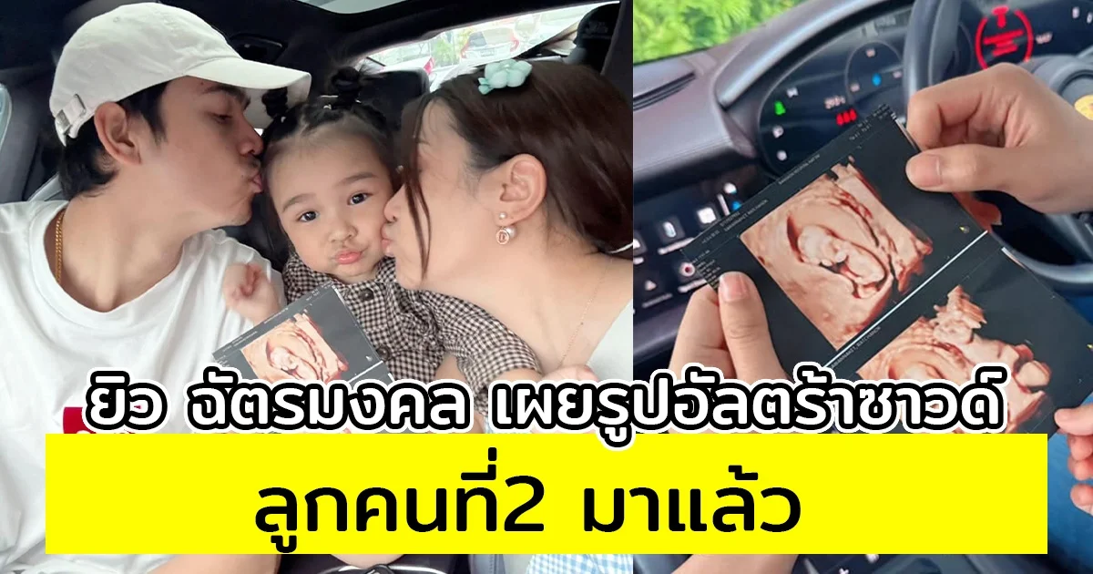 ประกาศเป็นทางการ ยิว ฉัตรมงคล เผยรูปอัลตร้าซาวด์ ลูกคนที่2 มาแล้ว