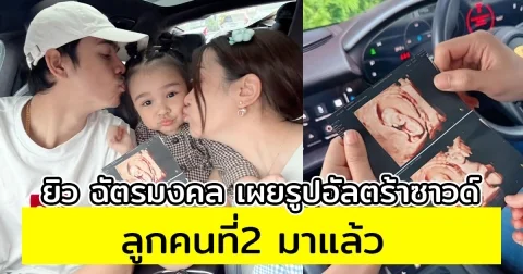 ประกาศเป็นทางการ ยิว ฉัตรมงคล เผยรูปอัลตร้าซาวด์ ลูกคนที่2 มาแล้ว