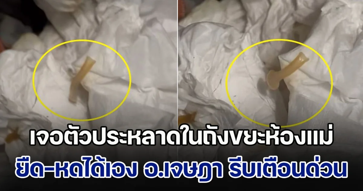 ลูกสงสัย เจอตัวประหลาดในถังขยะห้องแม่ ยืด-หดได้เอง อ.เจษฎา เตือนด่วน แนะรีบพาแม่ไปหาหมอ