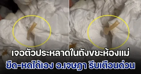 ลูกสงสัย เจอตัวประหลาดในถังขยะห้องแม่ ยืด-หดได้เอง อ.เจษฎา เตือนด่วน แนะรีบพาแม่ไปหาหมอ