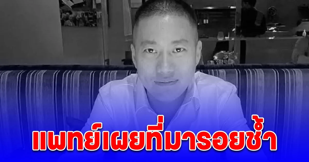 แพทย์เผยที่มารอยช้ำ ผู้กำกับโจ้