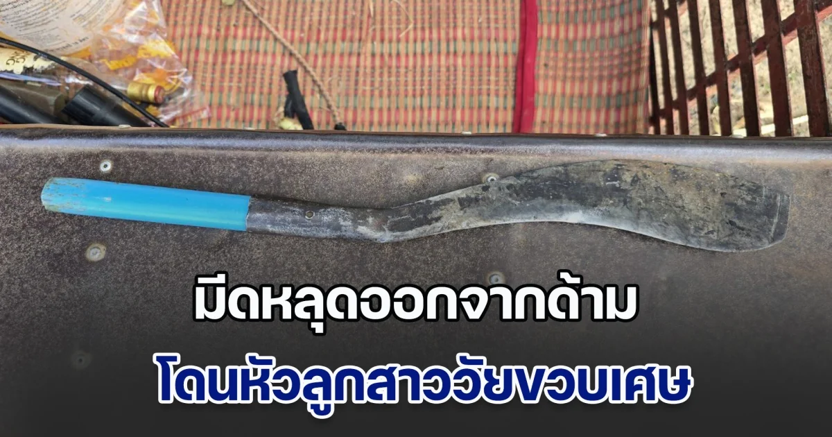 ใจหาย! พ่อใช้อีโต้ฟันไม้ มีดหลุดออกจากด้าม โดนหัวลูกสาววัยขวบเศษ แผลลึกถึงกะโหลก