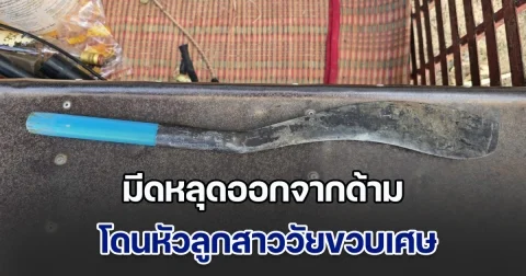ใจหาย! พ่อใช้อีโต้ฟันไม้ มีดหลุดออกจากด้าม โดนหัวลูกสาววัยขวบเศษ แผลลึกถึงกะโหลก