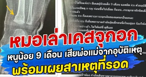 หมอเล่าเคสจุกอก หนูน้อย 9 เดือน ครอบครัวจากอุบัติเหตุ พร้อมเผยสาเหตุที่รอด