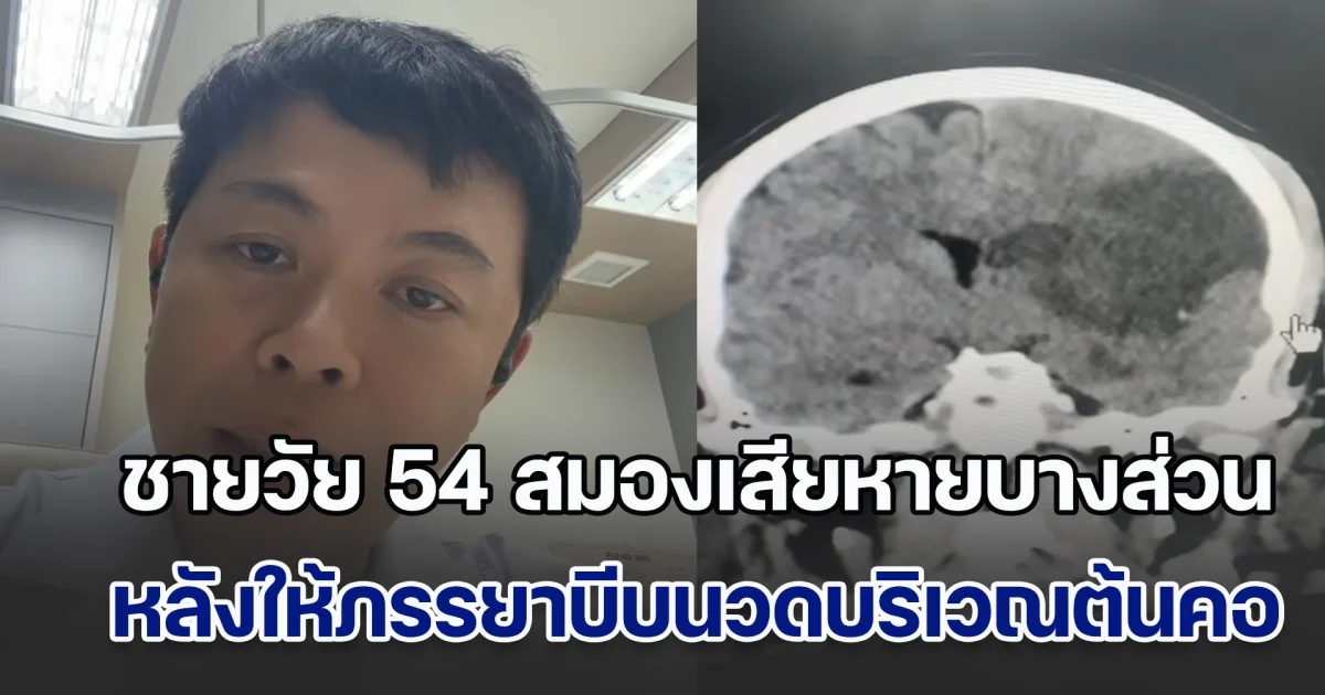 อย่าไว้ใจให้เมียนวด! แพทย์แชร์อุทาหรณ์ คนไข้ชายวัย 54 สมองเสียหายบางส่วน ทำแขนขาข้างขวาอ่อนแรง และไม่พูด