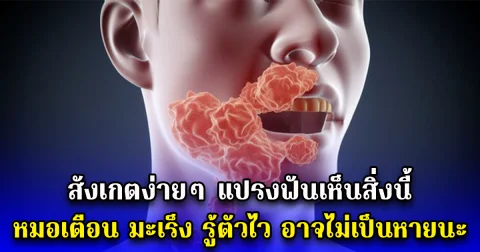 สังเกตง่ายๆ แปรงฟันเห็นสิ่งนี้ หมอเตือน มะเร็ง รู้ตัวไว อาจไม่เป็นหายนะ
