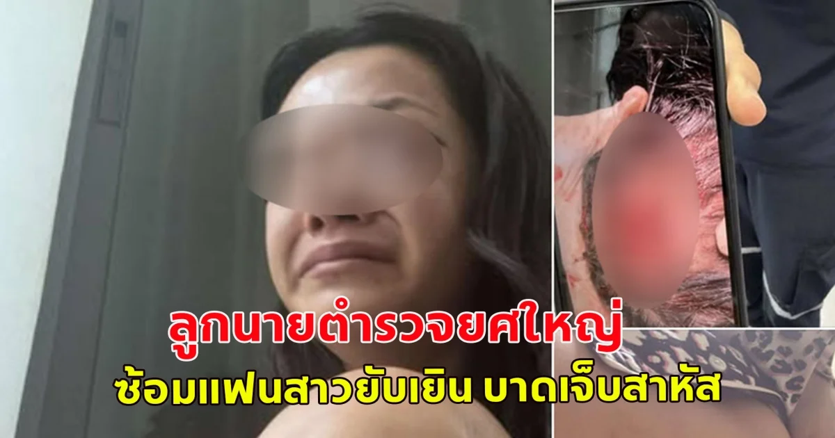 เพจดังแฉ! ลูกนายตำรวจยศใหญ่ ซ้อมแฟนสาวยับเยิน บาดเจ็บสาหัส