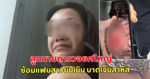 เพจดังแฉ! ลูกนายตำรวจยศใหญ่ ซ้อมแฟนสาวยับเยิน บาดเจ็บสาหัส