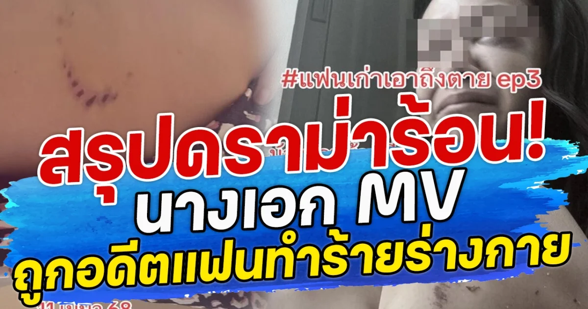 สรุปดราม่าร้อน! นางเอก MV ถูกอดีตแฟนทำร้ายร่างกาย