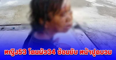 ผัว 34 ซ้อมเมีย 53 ยับหน้าปูดบวม ชาวบ้านสุดสงสาร