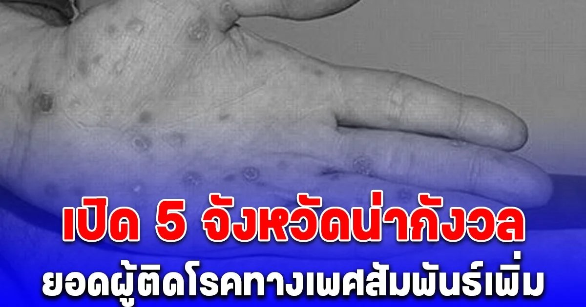 เปิด 5 จังหวัดน่ากังวล ยอดผู้ติดโรคทางเพศสัมพันธ์เพิ่ม