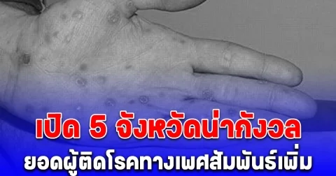 เปิด 5 จังหวัดน่ากังวล ยอดผู้ติดโรคทางเพศสัมพันธ์เพิ่ม