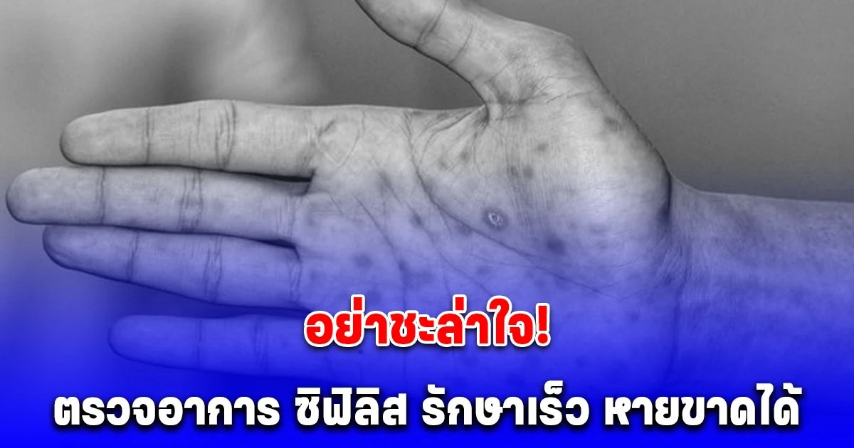 อย่าชะล่าใจ! ตรวจอาการ ซิฟิลิส รักษาเร็ว หายขาดได้ เปิด 5 จังหวัด เจอพุ่ง