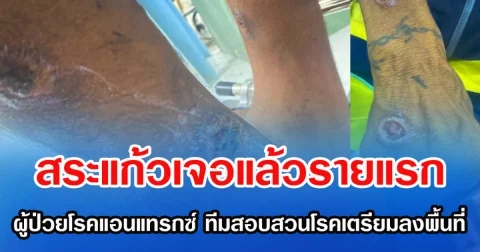 สระแก้วเจอแล้วรายแรก ผู้ป่วยโรคแอนแทรกซ์ ทีมสอบสวนโรคเตรียมลงพื้นที่