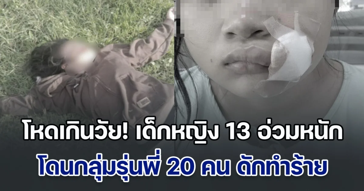 โหดเกินวัย! เด็กหญิง 13 อ่วมหนัก โดนกลุ่มรุ่นพี่ 20 คน ดักทำร้าย เน้นที่หัว-หน้า สุดท้ายปากฉีก เย็บ 20 เข็ม
