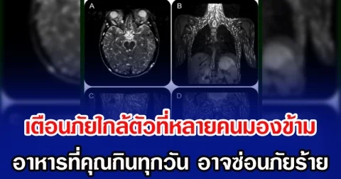 เตือนภัยใกล้ตัวที่หลายคนมองข้าม อาหารที่คุณกินทุกวัน อาจซ่อนภัยร้าย