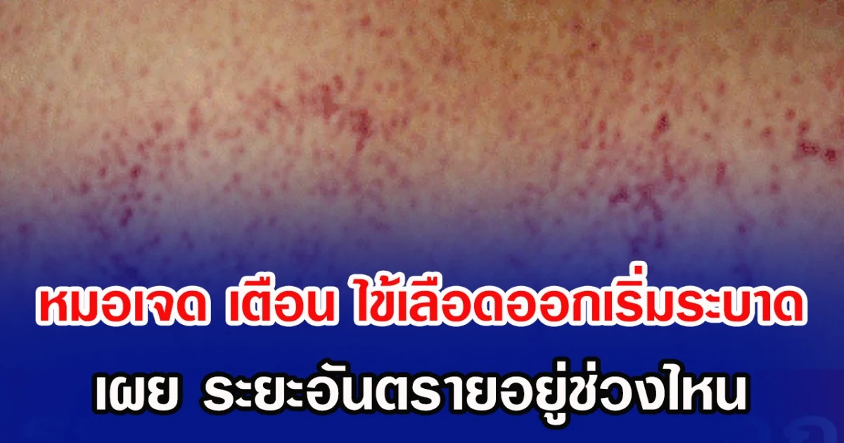 หมอเจดโพสต์เตือน ไข้เลือดออกเริ่มระบาดอีกระลอก  เผย ระยะอันตรายอยู่อยู่ช่วงไหน