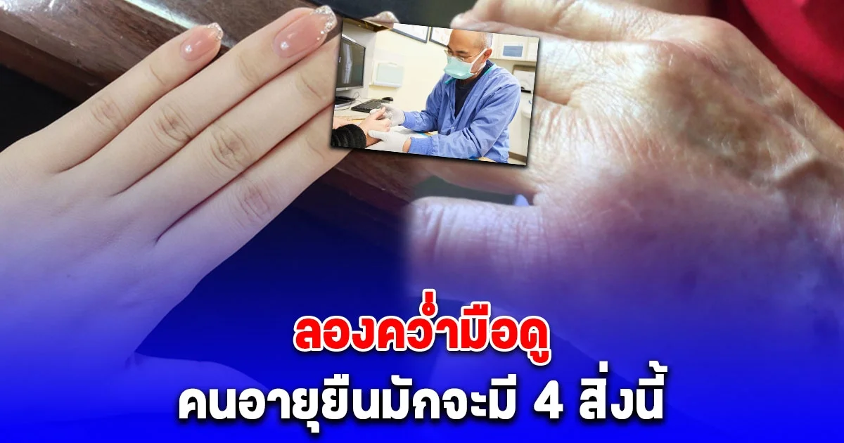 ลองคว่ำมือดู หมอระบุชัดเจน คนอายุยืนมักจะมี 4 สิ่งนี้