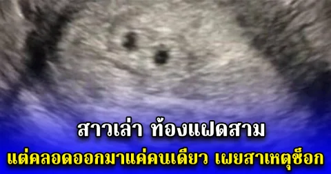 สาวเล่า ท้องแฝดสาม แต่คลอดออกมาแค่คนเดียว เผยสาเหตุช็อก