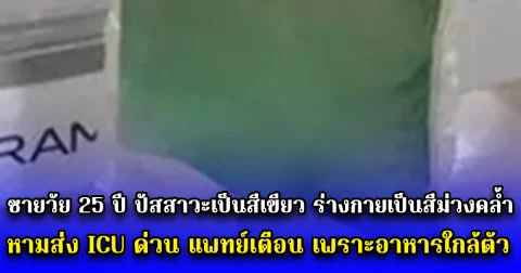 ชายวัย 25 ปี ปัสสาวะเป็นสีเขียว ร่างกายเป็นสีม่วงคล้ำ หามส่ง ICU ด่วน แพทย์เตือน เพราะอาหารใกล้ตัว