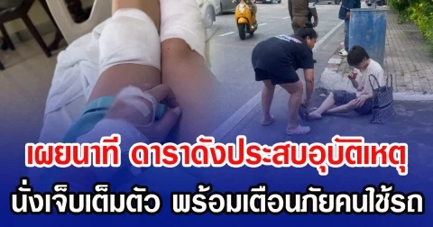 เผยนาที ดาราดังประสบอุบัติเหตุ นั่งเจ็บเต็มตัว พร้อมเตือนภัยคนใช้รถมอเตอร์ไซค์