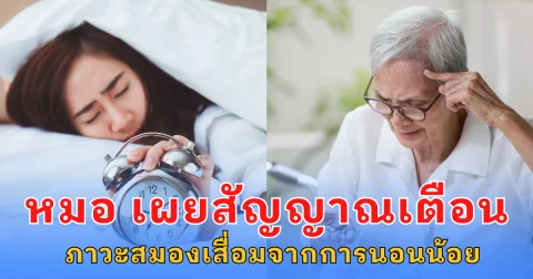 แพทย์เชี่ยวชาญ เผย สัญาณเตือน ภาวะสมองเสื่อมจากการนอนน้อย