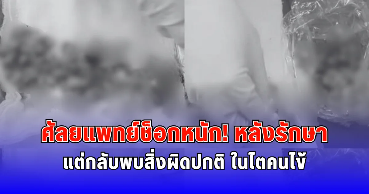 ศัลยแพทย์ช็อก หลังรักษา แต่กลับพบสิ่งผิดปกติ ในไตคนไข้ (ต่างประเทศ)