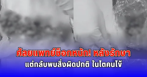 ศัลยแพทย์ช็อก หลังรักษา แต่กลับพบสิ่งผิดปกติ ในไตคนไข้ (ต่างประเทศ)