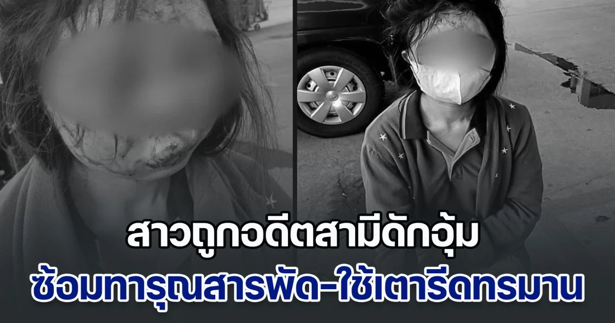 สาวถูกอดีตสามีดักอุ้ม ซ้อมทารุณสารพัด-ใช้เตารีดทรมาน จับขังบ้านข้ามวัน ก่อนจะหนีออกมาได้ แต่โดนตามข่มขู่ ผู้ก่อเหตุ อ้างรู้จักตำรวจเยอะ