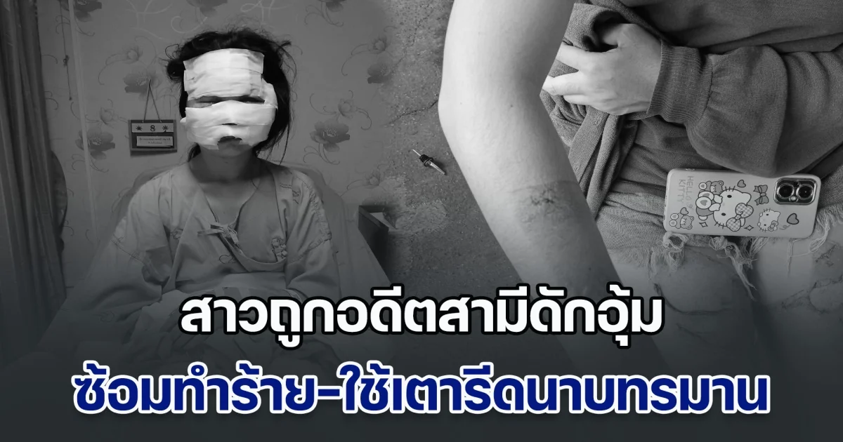 สาวถูกอดีตสามีดักอุ้ม ซ้อมทำร้าย-ใช้เตารีดนาบทรมาน ต่อหน้าลูก ฝ่ายหญิงร้องขอไป รพ. แต่กลับถูกจับขังบ้าน ซ้ำหนีออกมาได้ยังตามคุกคามไม่เลิก