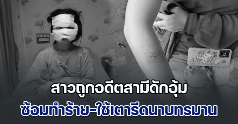 สาวถูกอดีตสามีดักอุ้ม ซ้อมทำร้าย-ใช้เตารีดนาบทรมาน ต่อหน้าลูก ฝ่ายหญิงร้องขอไป รพ. แต่กลับถูกจับขังบ้าน ซ้ำหนีออกมาได้ยังตามคุกคามไม่เลิก