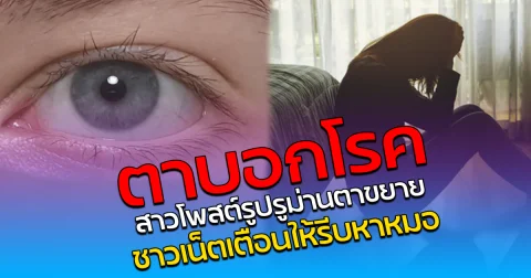 ตาบอกโรค สาวโพสต์รูปรูม่านตาขยาย ชาวเน็ตเตือนให้รีบหาหมอ