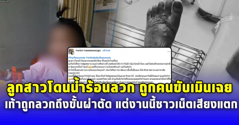 ลูกสาวโดนน้ำร้อนลวกบนรถรับส่ง กับถูกคนขับเมินเฉย เท้าถูกลวกถึงขั้นผ่าตัด แต่งานนี้ชาวเน็ตเสียงแตก