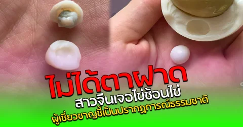 ไม่ได้ตาฝาด สาวจีนเจอไข่ซ้อนไข่ ผู้เชี่ยวชาญชี้เป็นปรากฏการณ์ธรรมชาติ