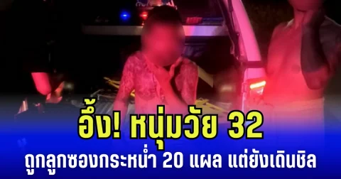 อึ้ง! หนุ่มวัย 32 ถูกลูกซองกระหน่ำ 20 แผล แต่ยังเดินชิล