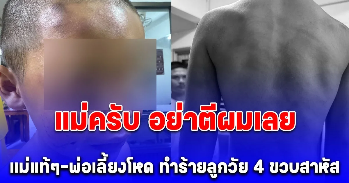 แม่แท้ๆ-พ่อเลี้ยงโหด รุมทุบตีทำร้ายลูกวัย 4 ขวบสาหัส