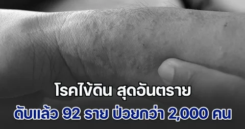 หน้าฝนต้องระวัง โรคไข้ดิน สุดอันตราย ดับแล้ว 92 ราย ป่วยกว่า 2,000 ราย เผยกลุ่มเสี่ยง