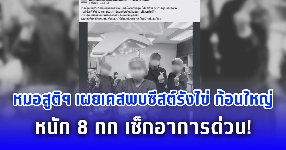 หมอสูติฯ เผยเคสพบซีสต์รังไข่ ก้อนใหญ่ หนัก 8 กก. เช็กอาการด่วน!